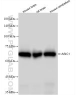 ASIC1 Recombinant monoclonal antibody 85089-1-RR proteintech
