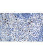 Rat MMP8 Recombinant monoclonal antibody, PBS Only 85211-4-PBS proteintech
