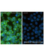 CXCL10/IP-10 Recombinant monoclonal antibody, PBS Only 85307-1-PBS proteintech