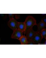 CLN5 Recombinant monoclonal antibody 85378-1-RR proteintech