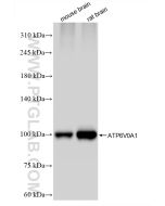 ATP6V0A1 Recombinant monoclonal antibody 85596-4-RR proteintech