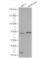 GNRHR Polyclonal antibody Proteintech  19950-1-AP