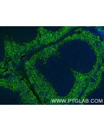 PGLYRP1 Recombinant monoclonal antibody 85610-4-RR proteintech