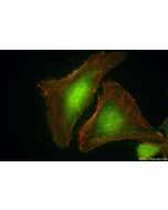 PAK2 Recombinant monoclonal antibody, PBS Only 85646-2-PBS proteintech