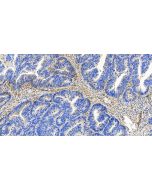 Tetranectin Recombinant monoclonal antibody, PBS Only 85689-5-PBS proteintech