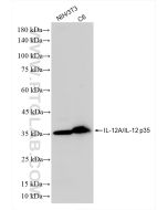 IL-12A/IL-12 p35 Recombinant monoclonal antibody 85754-2-RR proteintech