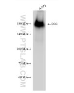DCC Recombinant monoclonal antibody, PBS Only (Capture) 85787-4-PBS proteintech