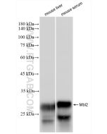 MBL Recombinant monoclonal antibody 85835-4-RR proteintech