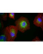ACADVL Recombinant monoclonal antibody 85889-1-RR proteintech