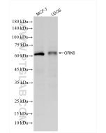 GRK6 Recombinant monoclonal antibody, PBS Only 85907-4-PBS proteintech