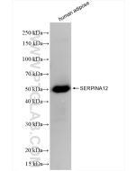 Serpin A12/Vaspin Recombinant monoclonal antibody 85908-5-RR proteintech