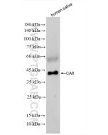 Carbonic Anhydrase 6/CA6 Recombinant monoclonal antibody 85940-3-RR proteintech