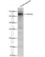 PAPP A2 Recombinant monoclonal antibody 85976-3-RR proteintech