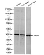ANGPTL4 Recombinant monoclonal antibody 86006-4-RR proteintech