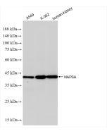 Napsin A Recombinant monoclonal antibody 86052-1-RR proteintech