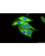 RRM1 Recombinant monoclonal antibody, PBS Only 86135-1-PBS proteintech