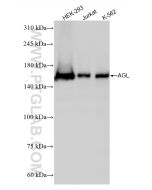 AGL Recombinant monoclonal antibody, PBS Only 86187-1-PBS proteintech