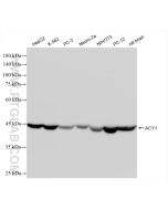 ACY1 Recombinant monoclonal antibody 86204-1-RR proteintech
