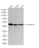 Cytokeratin 16 Recombinant monoclonal antibody 86235-1-RR proteintech
