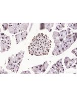 PRPF31 Recombinant monoclonal antibody 86315-1-RR proteintech