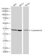 Cytokeratin 40 Recombinant monoclonal antibody, PBS Only 86531-2-PBS proteintech