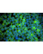 CD13 Recombinant monoclonal antibody, PBS Only 86620-3-PBS proteintech