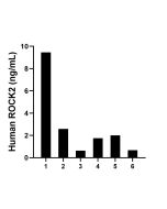 ROCK2 Recombinant monoclonal antibody, PBS Only (Capture) 86649-1-PBS proteintech