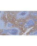 Rat VCAM-1/CD106 Recombinant monoclonal antibody, PBS Only 86797-1-PBS proteintech