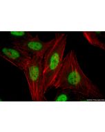 HAT1 Recombinant monoclonal antibody 86815-1-RR proteintech