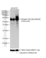 Phospho-TAU (Ser199/202) Recombinant monoclonal antibody 87053-2-RR proteintech