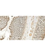 TRPM4 Recombinant monoclonal antibody 87085-1-RR proteintech