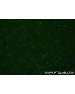 APLP1 Recombinant monoclonal antibody 87113-1-RR proteintech