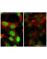 Phospho-KAP1 (Ser824) Recombinant monoclonal antibody 87309-1-RR proteintech