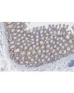 MMP7 Recombinant monoclonal antibody, PBS Only 87552-1-PBS proteintech