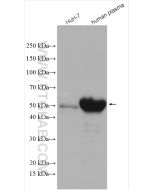 Angiotensinogen/AGT Polyclonal antibody Proteintech  11992-1-AP