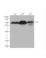RILP Recombinant monoclonal antibody Proteintech  82996-4-RR