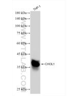 CHI3L1/YKL40 Recombinant monoclonal antibody Proteintech  83685-4-RR