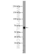 RUNX2 Polyclonal antibody Proteintech  20700-1-AP