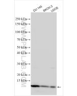 S100A11 Polyclonal antibody Proteintech  10237-1-AP