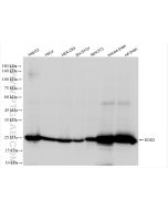 SOD2 Recombinant monoclonal antibody Proteintech  83519-4-RR
