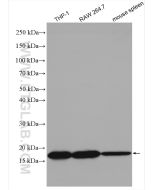 TIPE2/TNFAIP8L2 Polyclonal antibody Proteintech  15940-1-AP