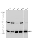 RNF31 / HOIP Recombinant monoclonal antibody Proteintech  83137-4-RR