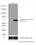 Phospho-AKT (Ser473) Monoclonal antibody Proteintech  66444-1-Ig