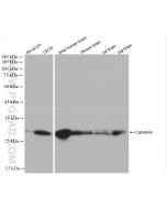 Calretinin Recombinant monoclonal antibody Proteintech  82811-1-RR