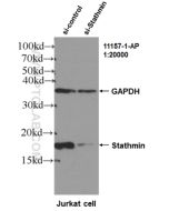 Stathmin 1 Polyclonal antibody Proteintech  11157-1-AP