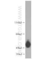 Cytokeratin 14 Polyclonal antibody Proteintech  10143-1-AP