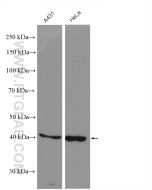 CYR61/CCN1 Polyclonal antibody Proteintech  26689-1-AP