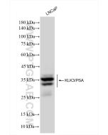 KLK3/PSA Recombinant monoclonal antibody Proteintech  84059-5-RR