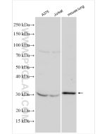 CTHRC1 Polyclonal antibody Proteintech  16534-1-AP