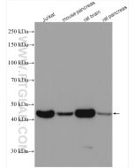 Beta Actin Monoclonal antibody Proteintech  66009-1-Ig